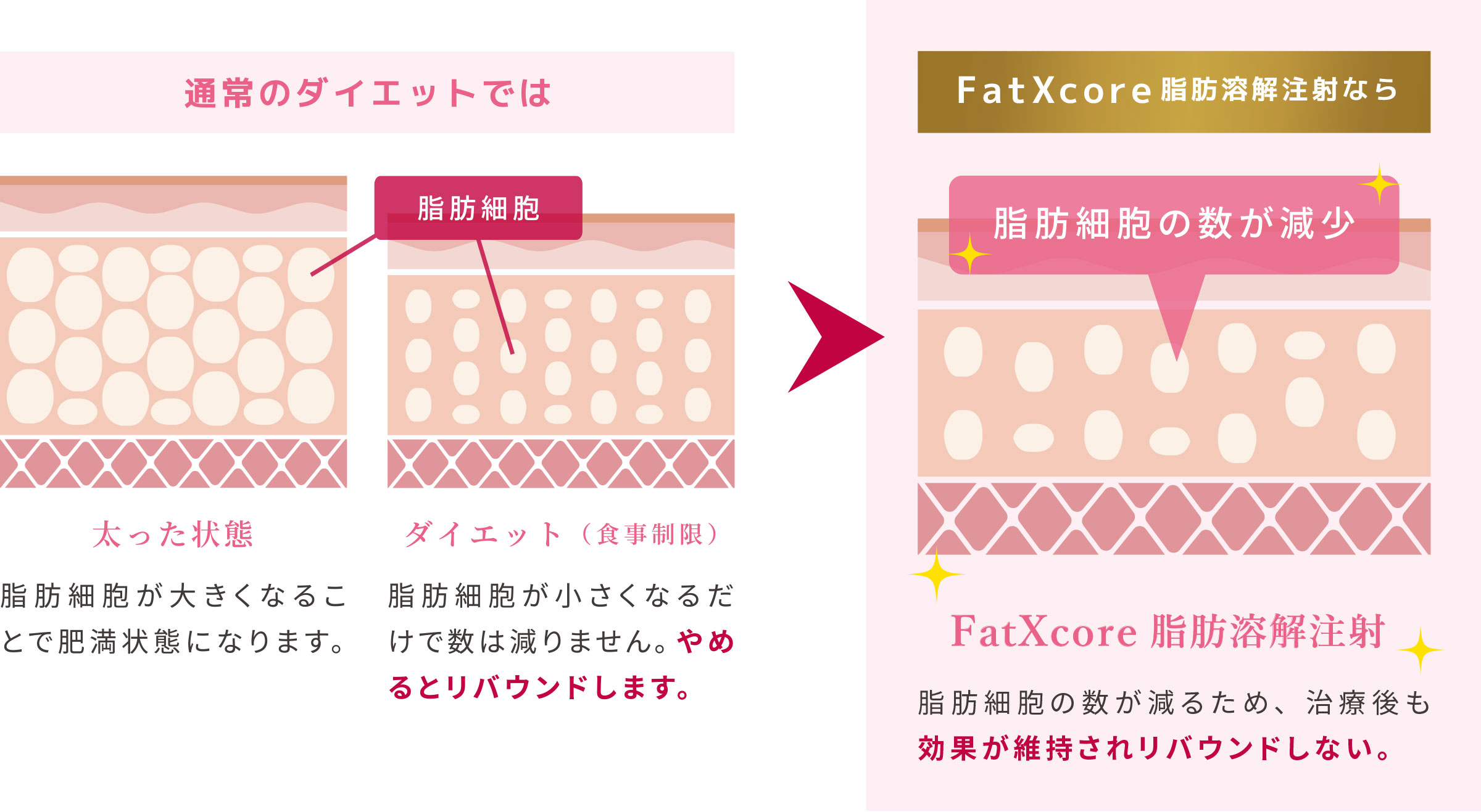FaTX脂肪融解注射